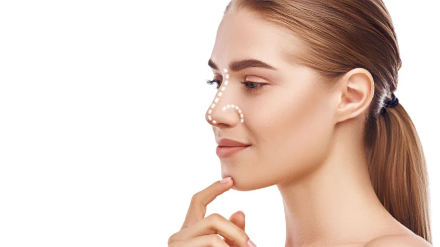 What Should You Know Before Closed Rhinoplasty?
