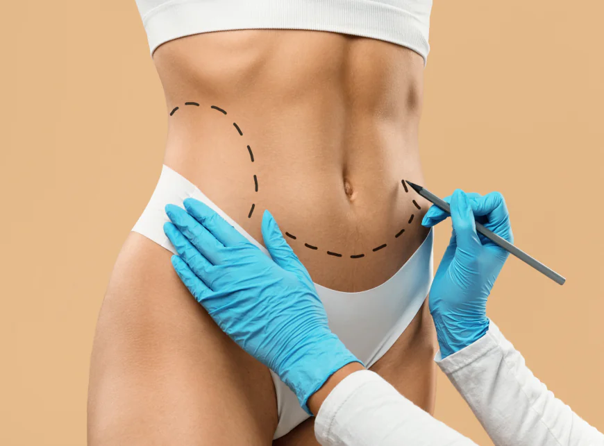 How Does Skin Respond to Laser Liposuction?