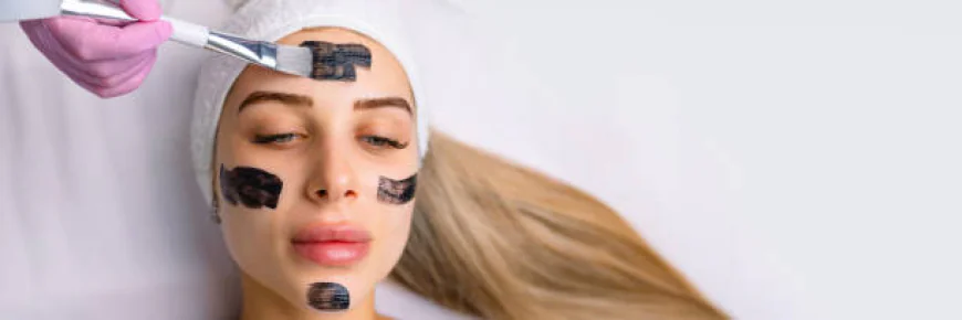 What can Laser carbon peel do for dull facial skin?