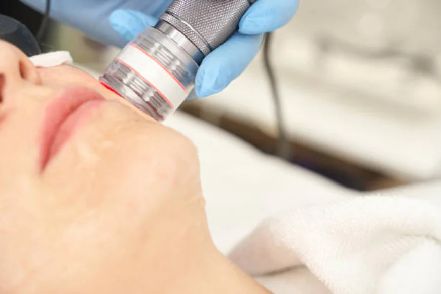 What Can Pico Laser Treatment Do for Acne Marks?