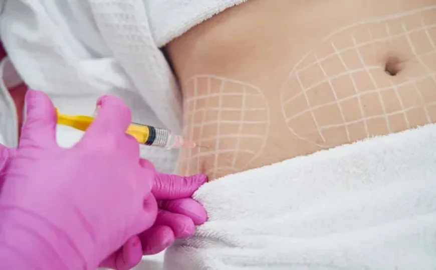 Can Fat Reduction Treatments in Islamabad Help Refine Stubborn Fat Areas?