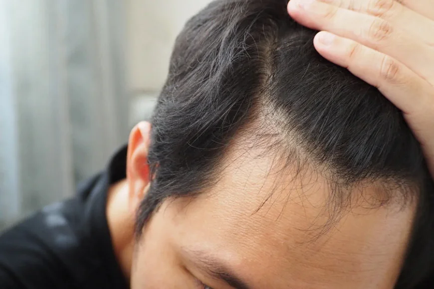 How Can Hair Loss Treatment Improve Hair Growth?