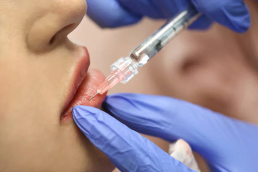 Does Lip Filler Injection require significant downtime