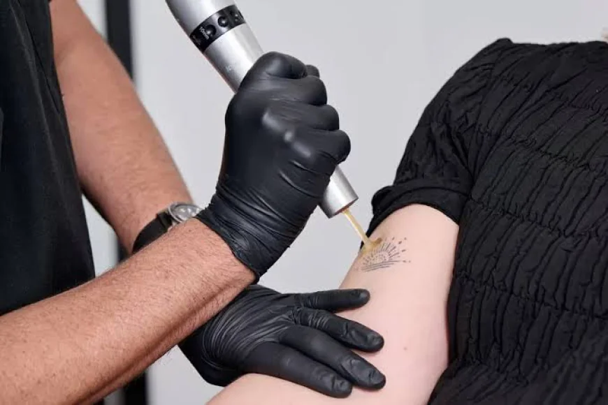 Is Tattoo Removal Suitable for Every Skin Type?