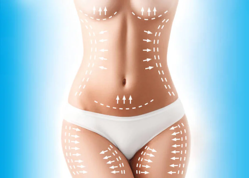 Can Sculpsure Body Contouring treat multiple areas