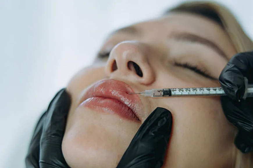 Build Confidence with Personalized Lip Fillers