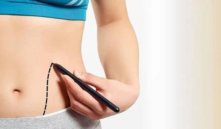 Liposuction Surgery in Dubai: A Comprehensive Guide for Beginners
