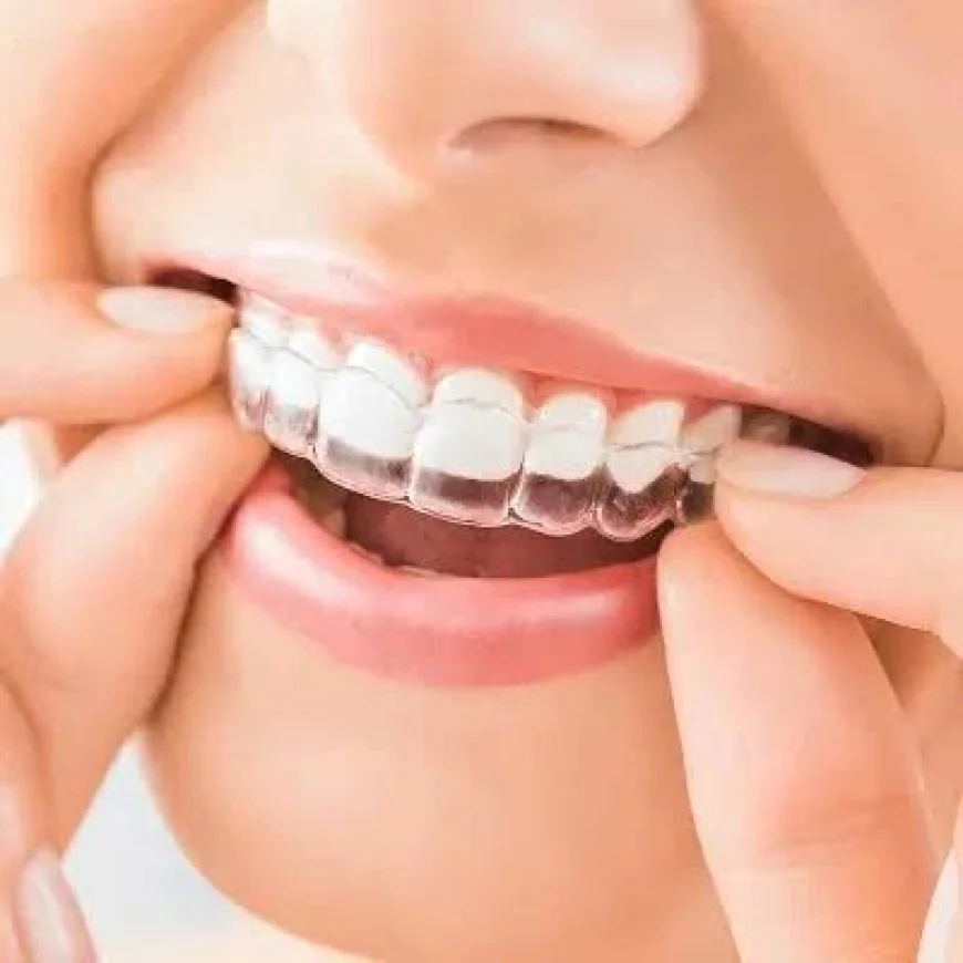 Start Your Smile Journey with Invisible Aligners Dubai & Abu Dhabi | Glamorous Clinic Dubai