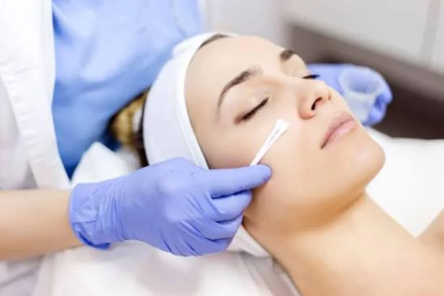 How Does Glycolic Acid Peel Improve Skin Texture and Tone?