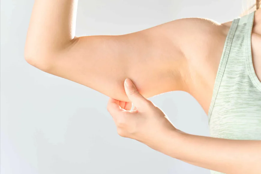 What Happens During an Arm Lift Surgery?