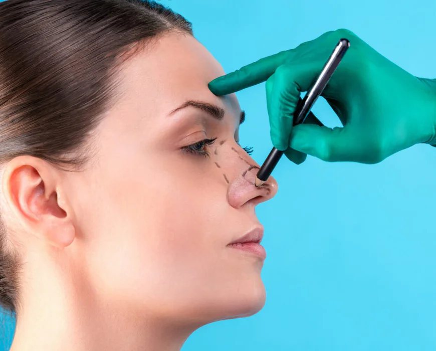 How Long Do Rhinoplasty Results Last in Jeddah?