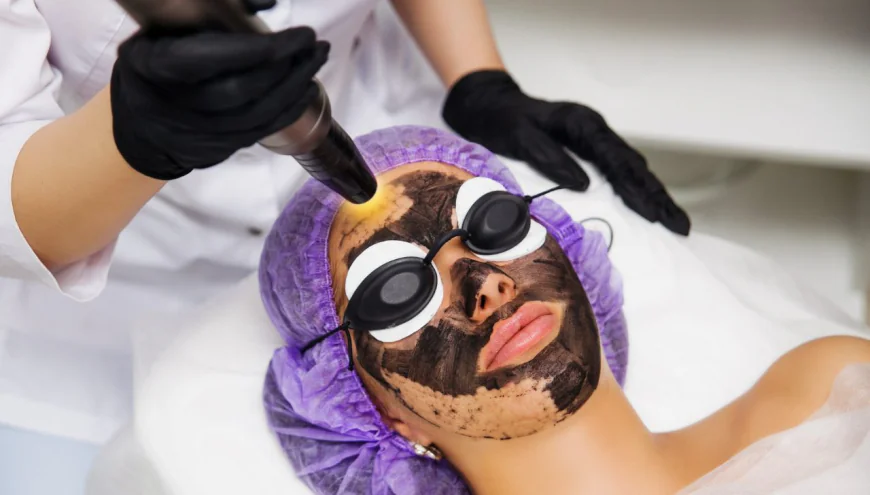 Can Laser Carbon Peel Reduce Uneven Facial Tone More Easily?