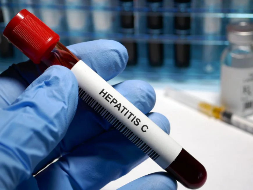 When Should You Consider Hepatitis C Testing?
