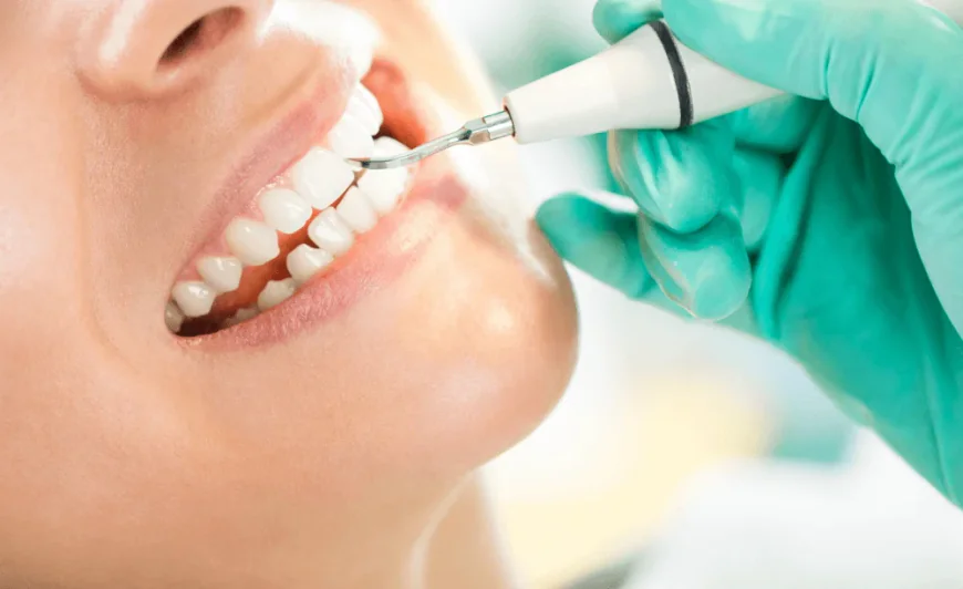 What Can You Expect From Teeth Scaling?