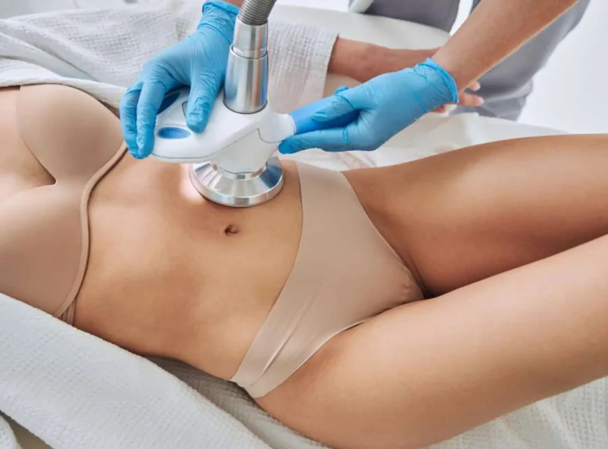 What Areas Can Laser Liposuction Treat Effectively?