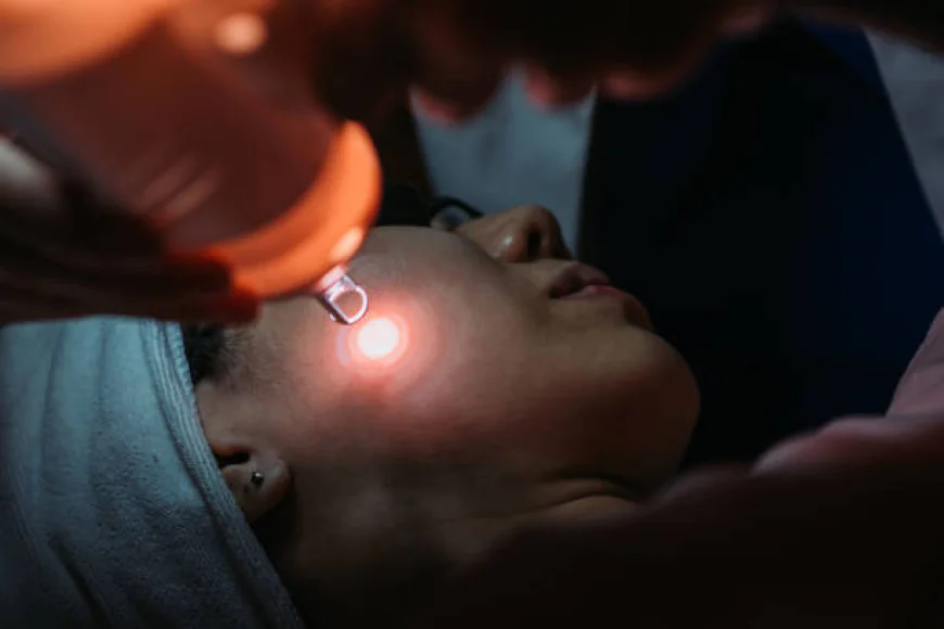 How Does Pico Laser Treatment Improve Pigmented Areas?
