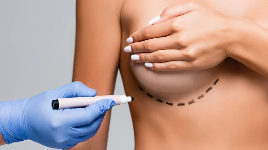Inverted Nipple Surgery: Procedure and Treatment Options
