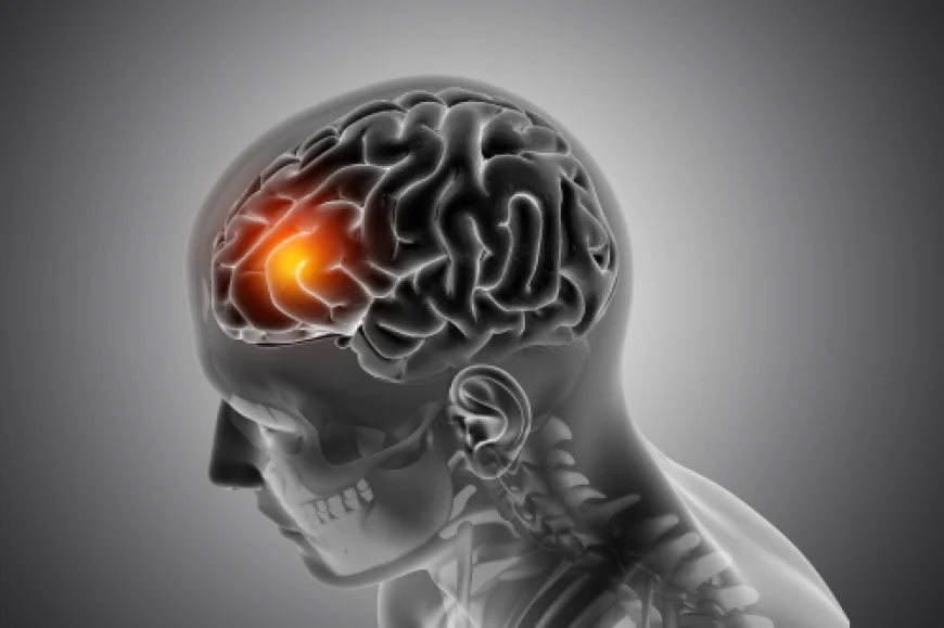 Early Warning Signs of Brain Tumors You Should Know
