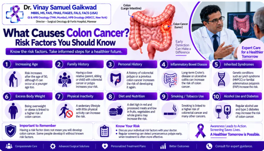 What Causes Colon Cancer? Risk Factors You Should Know