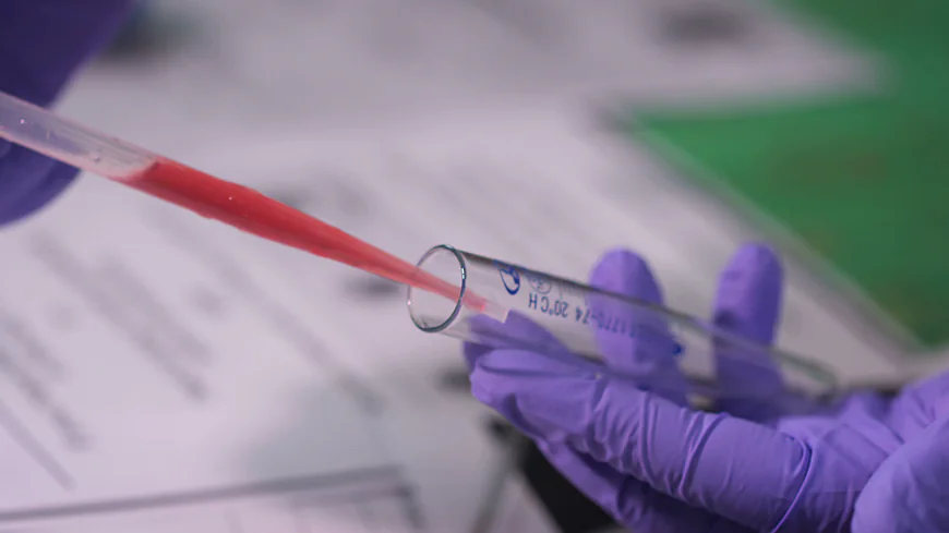 Blood Test At Home for Comfortable Care