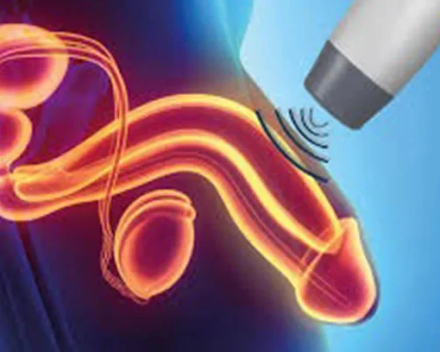 Penile Shock Wave Therapy in Lucknow: Procedure, Benefits and Considerations