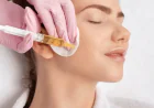Experience Natural-Looking Results with PRP Treatment
