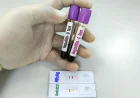Questions to Ask Before Hepatitis B Testing