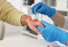 Minor Burn Treatment: Essential Steps for Safe Burn Care