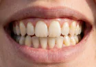 Family Dental Clinic in DHA Lahore | Modern Dental Care