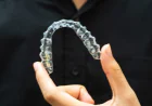 Clear Aligners: A Practical Guide to Straighter Teeth and Better Oral Function