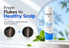 Best Shampoo for Dandruff: What Should You Buy?