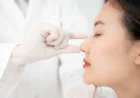 What Are the Common Risks and Complications of Rhinoplasty?