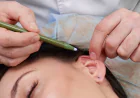 Microtia in Children: What Parents Should Know About Ear Surgery