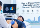 How to Choose the Best Diagnostic Labs for Fibroscan Test in Delhi?