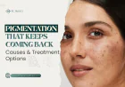 Pigmentation That Keeps Coming Back: Causes & Treatment Options