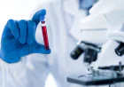 Benefits of Booking a Blood Test At Home