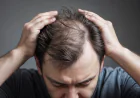 Hair Loss Is Common, But You Do Not Have to Live With It