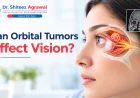 Can Orbital Tumors Affect Vision? Symptoms, Causes, and Treatment Options