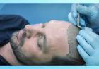 Planning a Hair Transplant in Gurgaon? Start With These Essential Facts