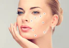 How Can 8 Point Facelift Restore a Youthful Look?