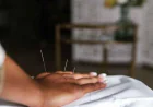 Acupuncturists Oakland: Aesthetic Results, Month by Month