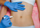 What Can Body Fillers Do for Body Shape?