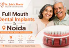 Are Full Mouth Dental Implants Suitable for Older Adults?