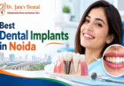 Are Dental Implants Suitable for Patients with Diabetes?