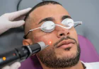 Is Pico Laser Treatment Effective for Sun Damage?