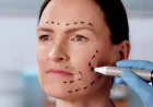 Want to Bring Back a Fresher Facial Look?