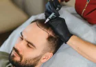 How long does FUE Hair Transplant recovery usually take?