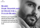 Beard Hair Transplant Clinic: What Every Man in India Should Know Before Deciding