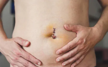 How Does Skin Lesion Removal Treat Skin Tags?
