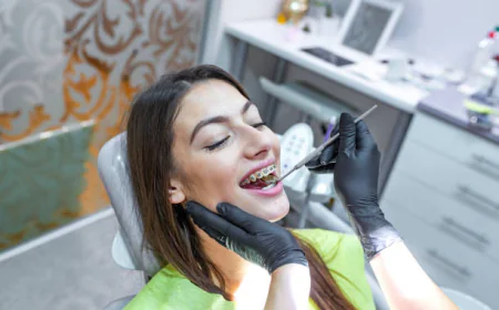 Dental Braces: Types and Options Explained